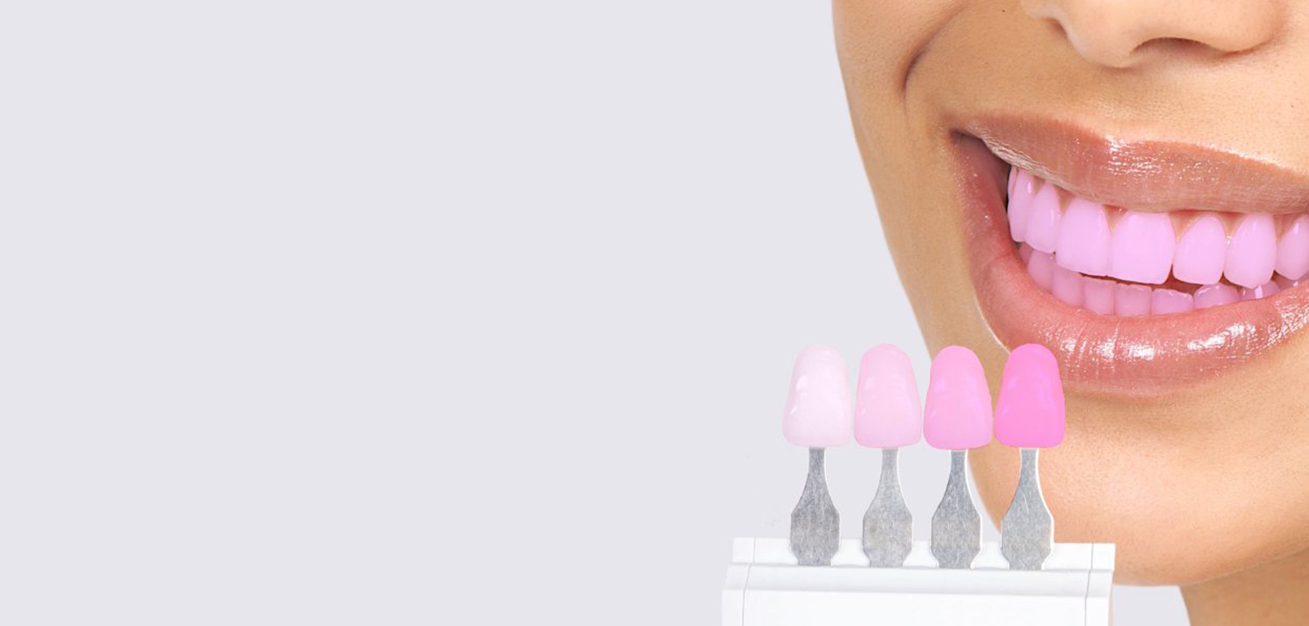 Розовые виниры